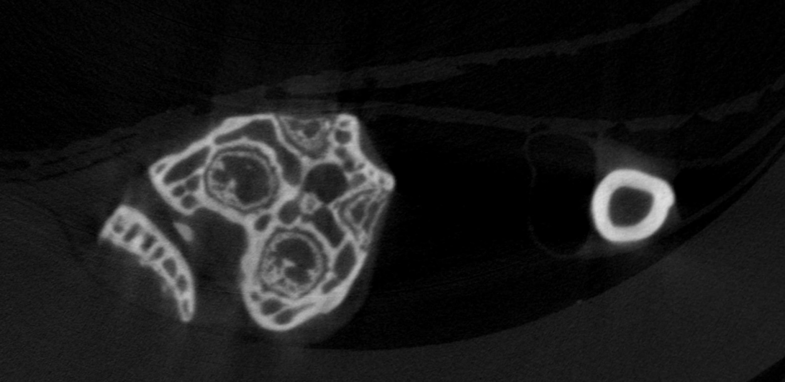 CT scan image of a forelimb cross-section